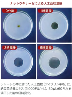 納豆菌培養エキス「NSK-SD」（ナットウキナーゼ高含有）　株式会社日本生物.科学研究所（東京支社）