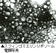 スフィンゴミエリンリポソーム電顕写真