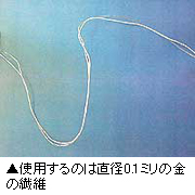 金の糸美容術
