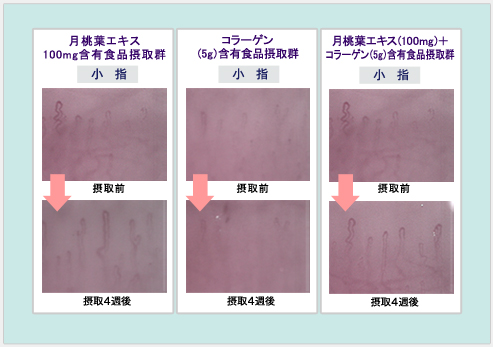 月桃葉摂取による血流検査結果
