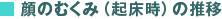 顔のむくみ(起床時)の推移