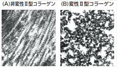 非変性Ⅱ型コラーゲンと変性コラーゲン