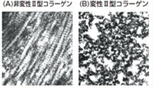 非変性Ⅱ型コラーゲンと変性コラーゲン