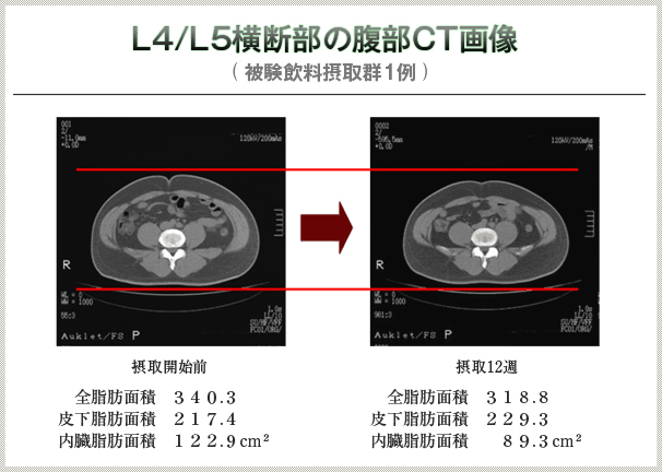 摂取開始前と摂取後12週の比較　横断部の腹部CT画像試験データ