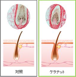 ケラナット（KERANAT）を使用した毛根