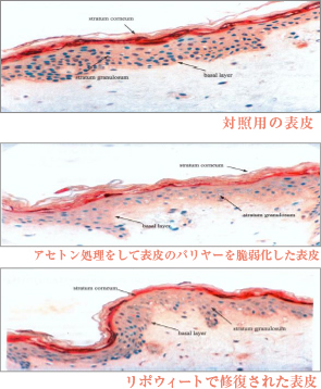 リポウィート（lipowheat）で修復された表皮