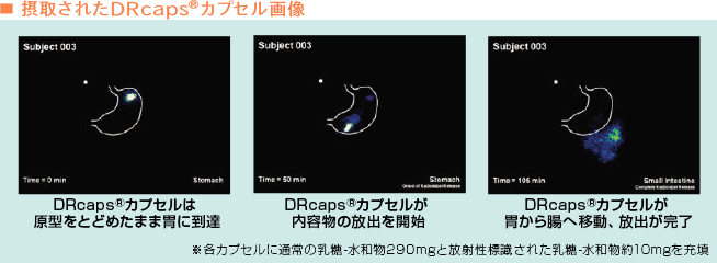 摂取されたDRcapsのカプセル画像