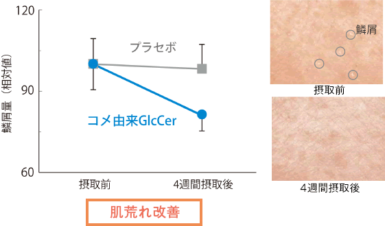 肌荒れの改善が確認された