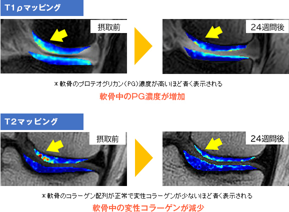 プロテオグリカン群による変形性膝関節病改善作用