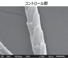コントロール群