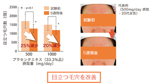 目立つ毛穴を改善