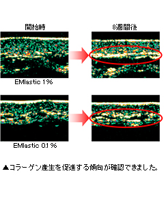 EMlastic®