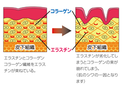 エラスチン PROLASTIN