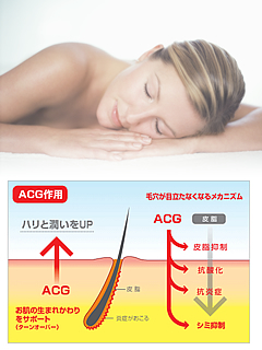 ACGコンプレックス