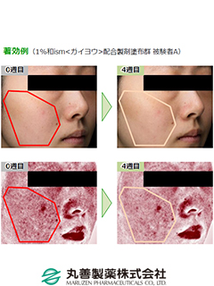 和ism®<ガイヨウ>　丸善製薬株式会社（薬粧部）