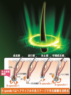 バージョンアップ