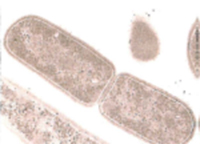 ラブレ菌顕微鏡写真